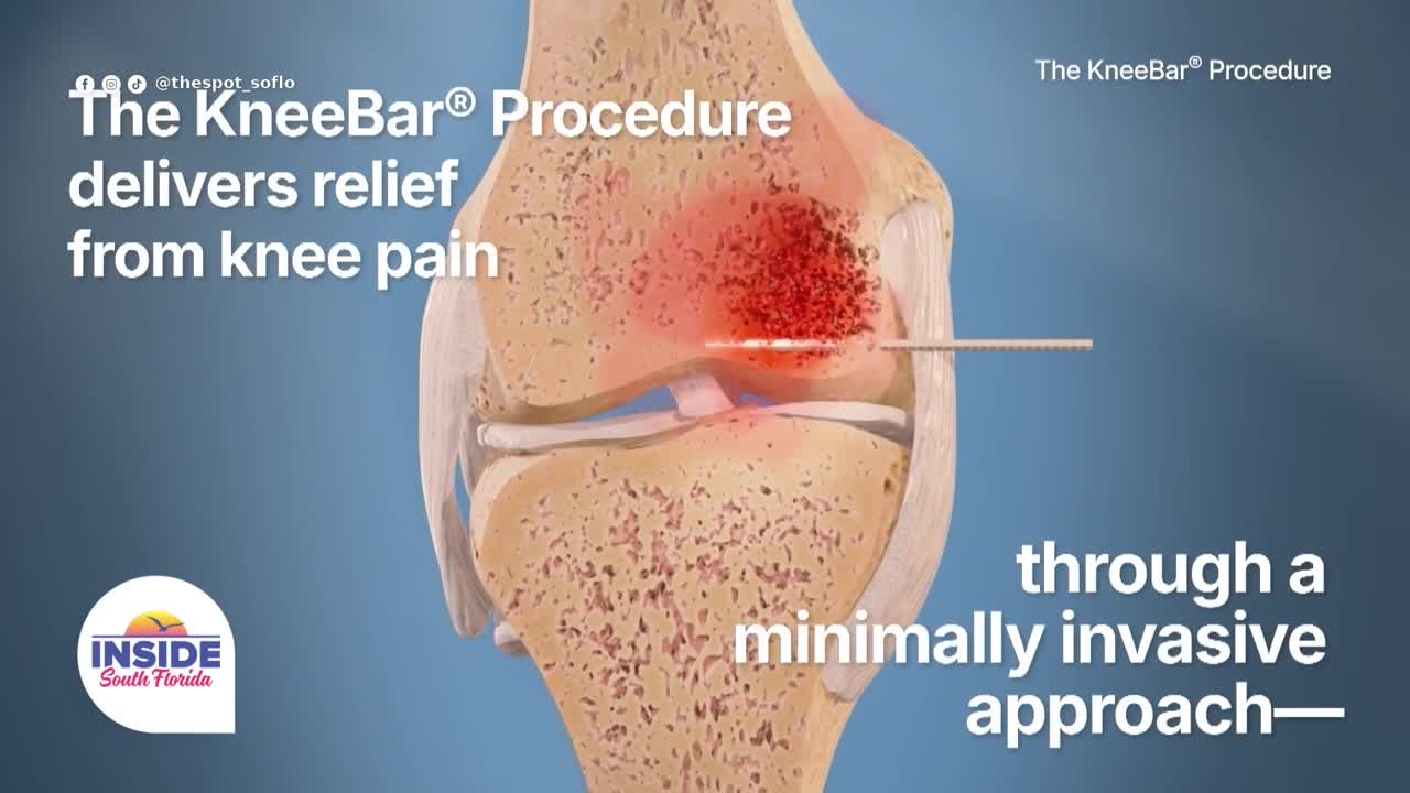 Minimally invasive knee procedure offers relief for patients with cartilage disease and bone pain
