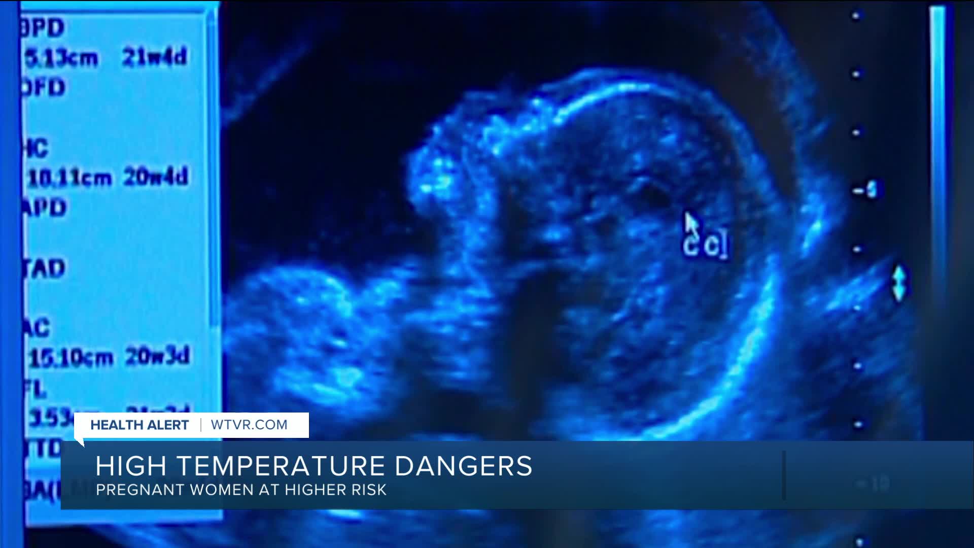 Extreme heat can cause pregnancy complications, health experts say